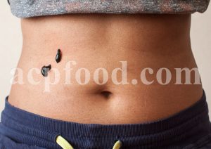 Leech Therapy or Hirudo Therapy