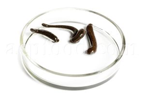 Leech Therapy or Hirudo Therapy